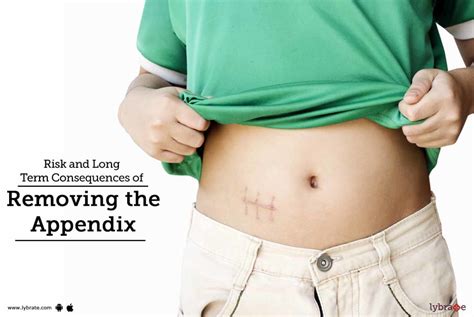Does no appendix have long term effects?